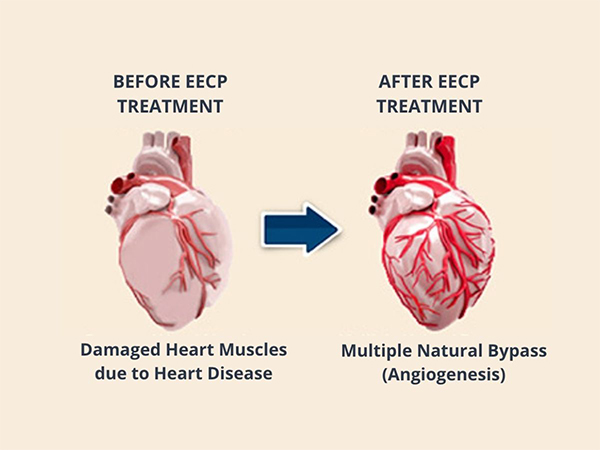 改善整體心臟的血流，增加心血管的循環