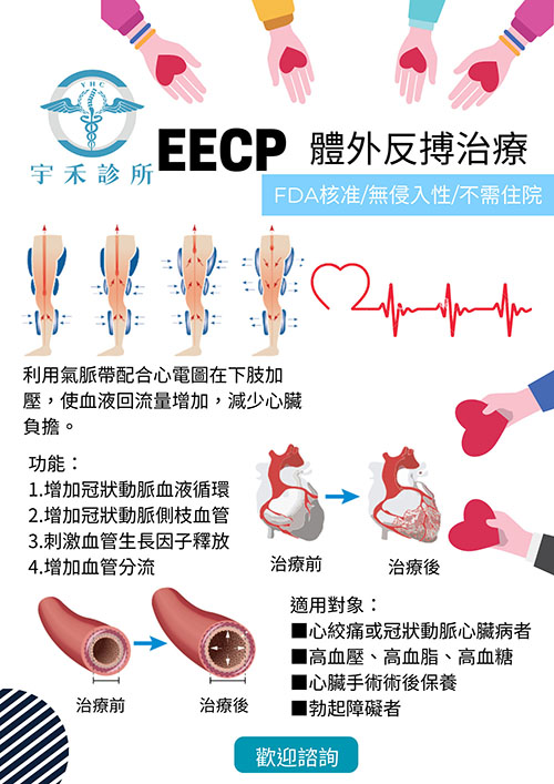 EECP體外反搏治療